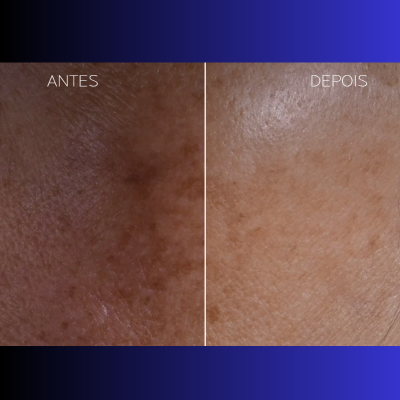La Roche-Posay Mela B3 Double Dose Emulsão 40ml | Farmácia d'Arrábida