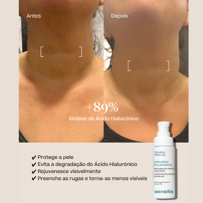 Sensilis Coffret Photocorrection HA SPF50 + Sérum Hialurónico | Farmácia d'Arrábida