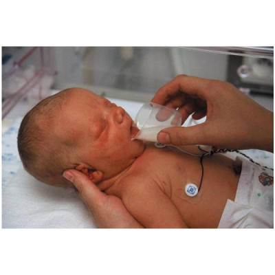 Medela Copos Graduados 10x35ml