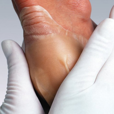 Hartmann Hydrocoll Penso 5x5cm x10