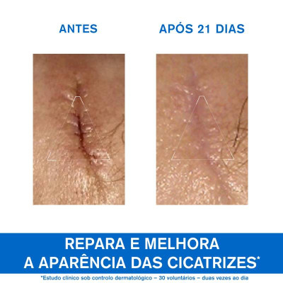 Uriage Bariéderm-CICA Creme 100ml | Farmácia d'Arrábida