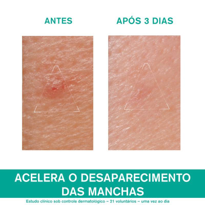 Uriage Hyséac Pasta SOS 15g | Farmácia d'Arrábida