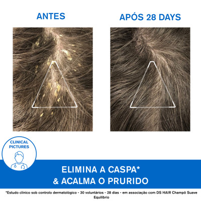 6271981 Uriage DS Champô Tratamento Queratorregulador 150ml