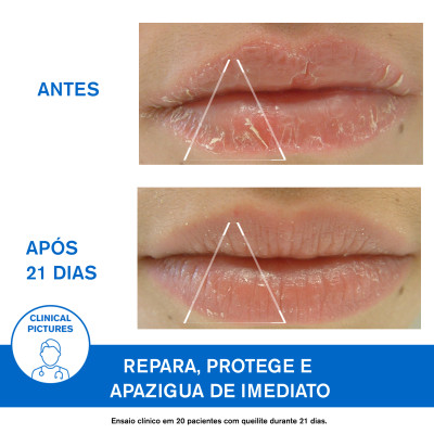 6804526  Uriage Bariéderm-CICA Bálsamo Labial 15ml