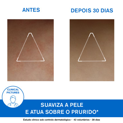 6986620 Uriage Xémose Cérat Creme 200ml