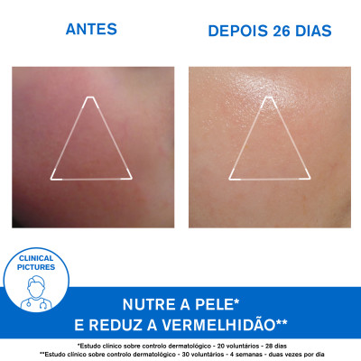 6916684  Uriage Xémose Creme 40ml