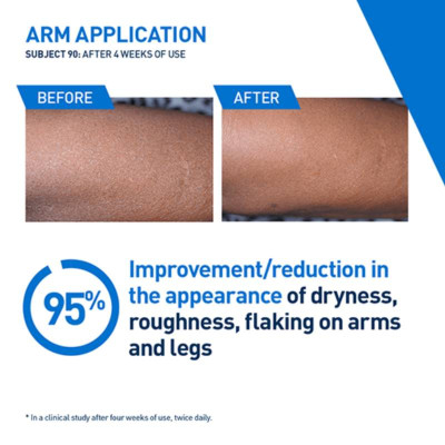 7404954_4 CeraVe Loção Hidratante Intensiva 473ml