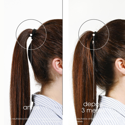 Klorane Sérum Fortificante Intenso Antiqueda Quinina 100ml | Farmácia d'Arrábida