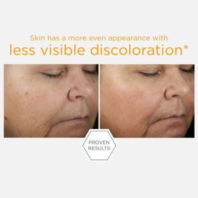 Neostrata Enlighten 15% Vitamin C + PHA Sérum 15ml  | Farmácia d'Arrábida