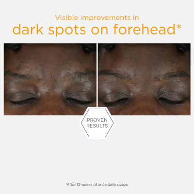 Neostrata Enlighten 15% Vitamin C + PHA Sérum 15ml  | Farmácia d'Arrábida