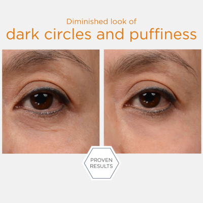 Neostrata Enlighten Creme Olhos Iluminador 15g | Farmácia d'Arrábida