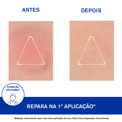 Uriage Cica-Daily Recarga Creme Reparador 50ml | Farmácia d'Arrábida