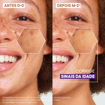 A-Derma Epitheliale Sérum Vit C 30ml | Farmácia d'Arrábida