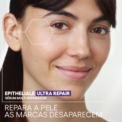 A-Derma Epitheliale Ultra Repair Sérum HA+ 30ml | Farmácia d'Arrábida