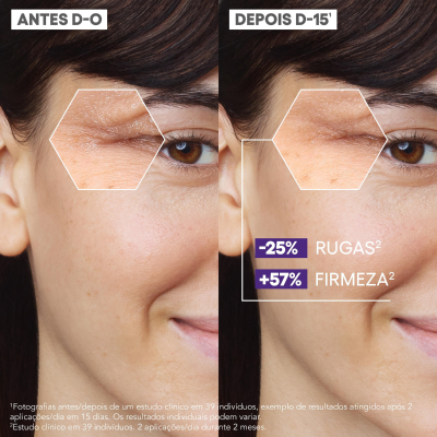 A-Derma Epitheliale Ultra Repair Sérum HA+ 30ml | Farmácia d'Arrábida