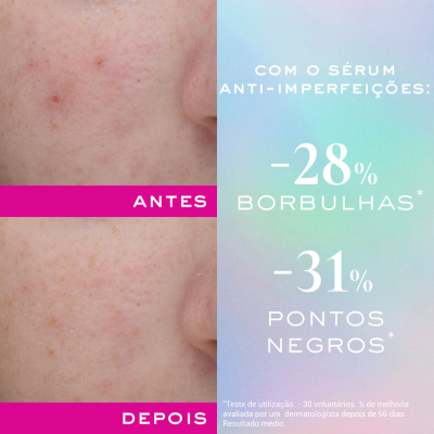 Nuxe Zinc Power Sérum Anti-Imperfeições 30ml | Farmácia d'Arrábida