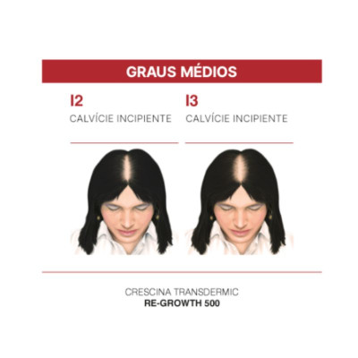 Crescina Transdermic HFSC Tratamento Capilar Completo 500 Mulher | Farmácia d'Arrábida
