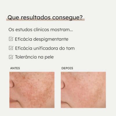 MartiDerm Pigment Zero DSP-Creme FPS 50+ 40ml | Farmácia d'Arrábida