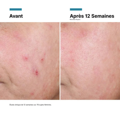 SkinCeuticals Advanced RGN-6 Creme 50ml | Farmácia d'Arrábida