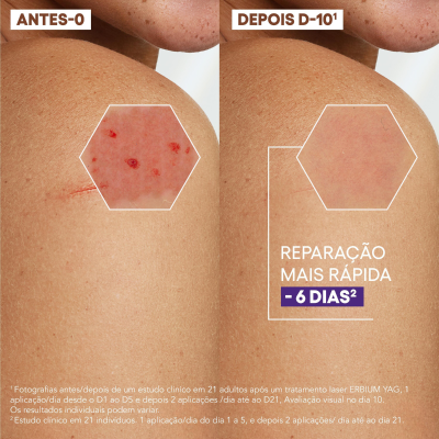 A-Derma Epitheliale A.H Ultra Creme Reparador 100ml | Farmácia d'Arrábida