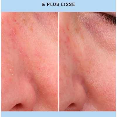 Etat Pur Óleo Bifásico 28ml | Farmácia d'Arrábida