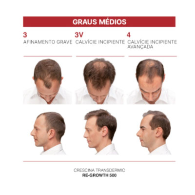 Crescina HFSC Tratamento Capilar Completo 1300 Homem | Farmácia d'Arrábida