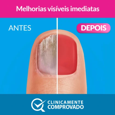 Excilor Forte Color Verniz Vermelho 30ml | Farmácia d'Arrábida