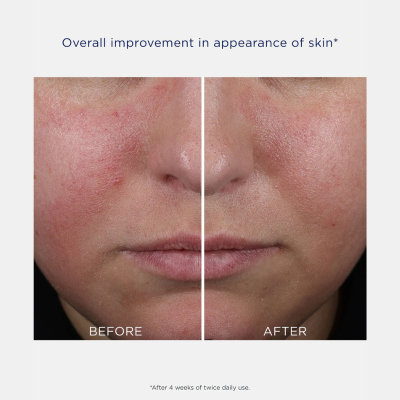 NEOSTRATA Skin Active Rebound Sculpting Cream 50g | Farmácia d'Arrábida