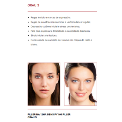 Fillerina EF 12A Densifying-Filler Creme Dia 50ml Grau 3 | Farmácia d'Arrábida