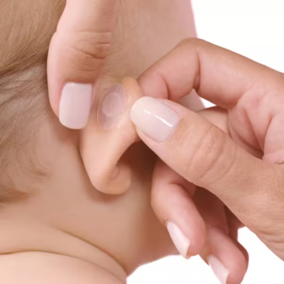 Otostick Baby Corretor Estético para Orelhas x8 + Touca | Farmácia d'Arrábida
