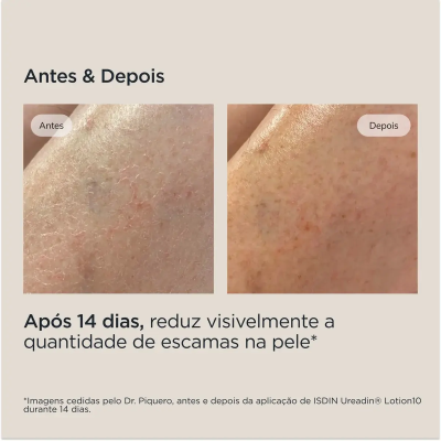 ISDIN Pack Ureadin Gel 1L + Lotion10 200ml | Farmácia d'Arrábida